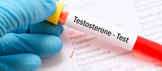 Diagnosis of Low Testosterone Levels