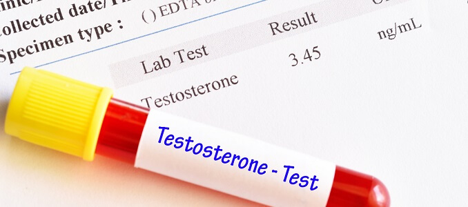 Testing for Testosterone Deficiency