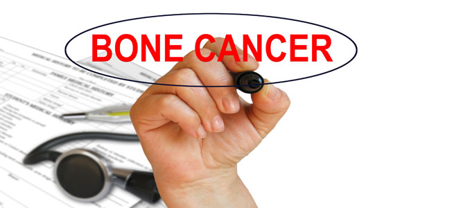 Bone Cancer and Hormone Treatment