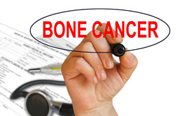 Bone Cancer